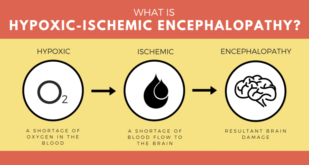 hypoxic-ischemic encephalopathy